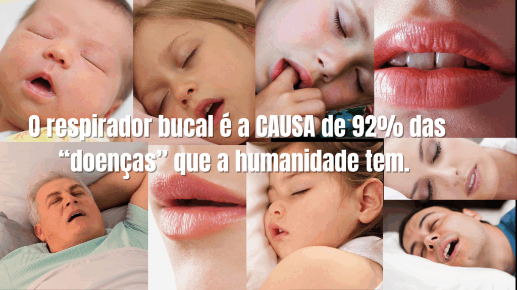 rascunho-antigo-cursoodontocronicos-4-1-1024x576 Por Que o Respirador Bucal é o Maior Problema de Saúde do Mundo?